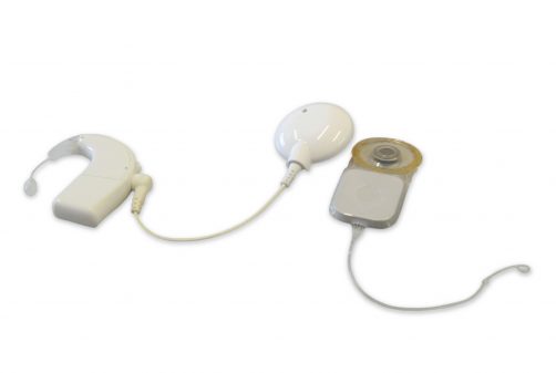 HRAC/Centrinho-USP: Dispositivos auditivos