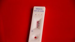 Aparelho para testa malaria. Foto: Cecília Bastos/USP Imagem